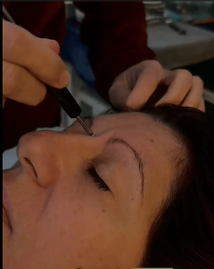 reflexologie faciale